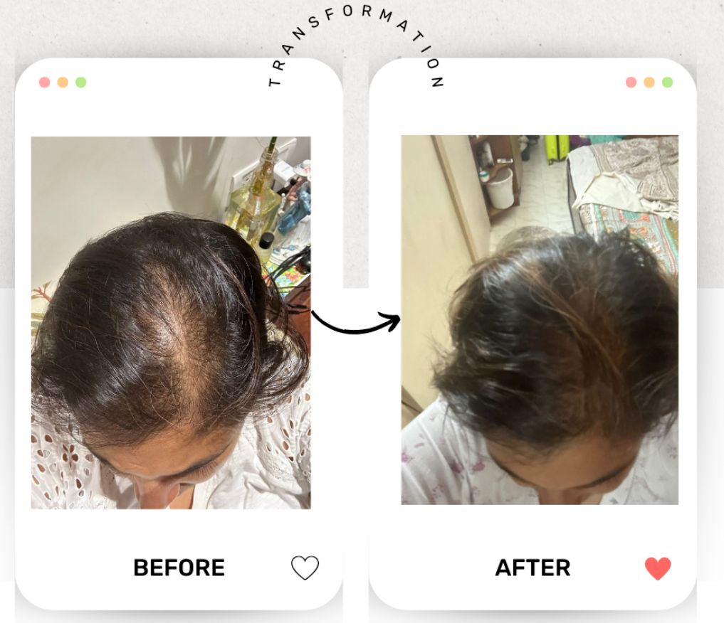 Hair Result